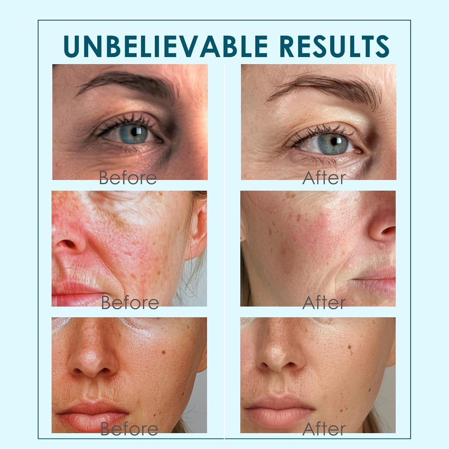 Facial Ice Globes