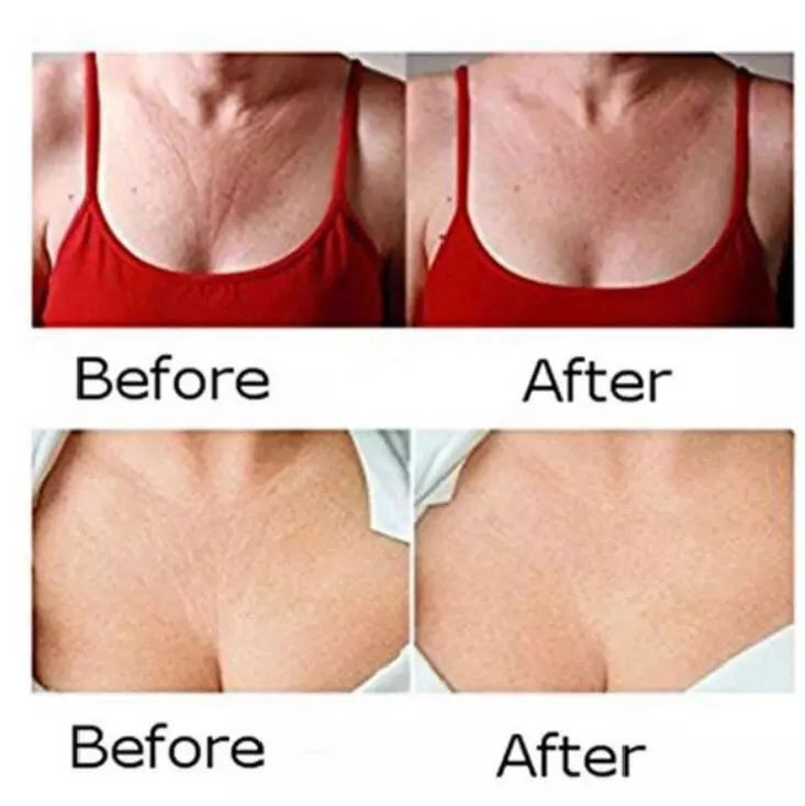 Reusable Silicone Anti-Wrinkle Pads