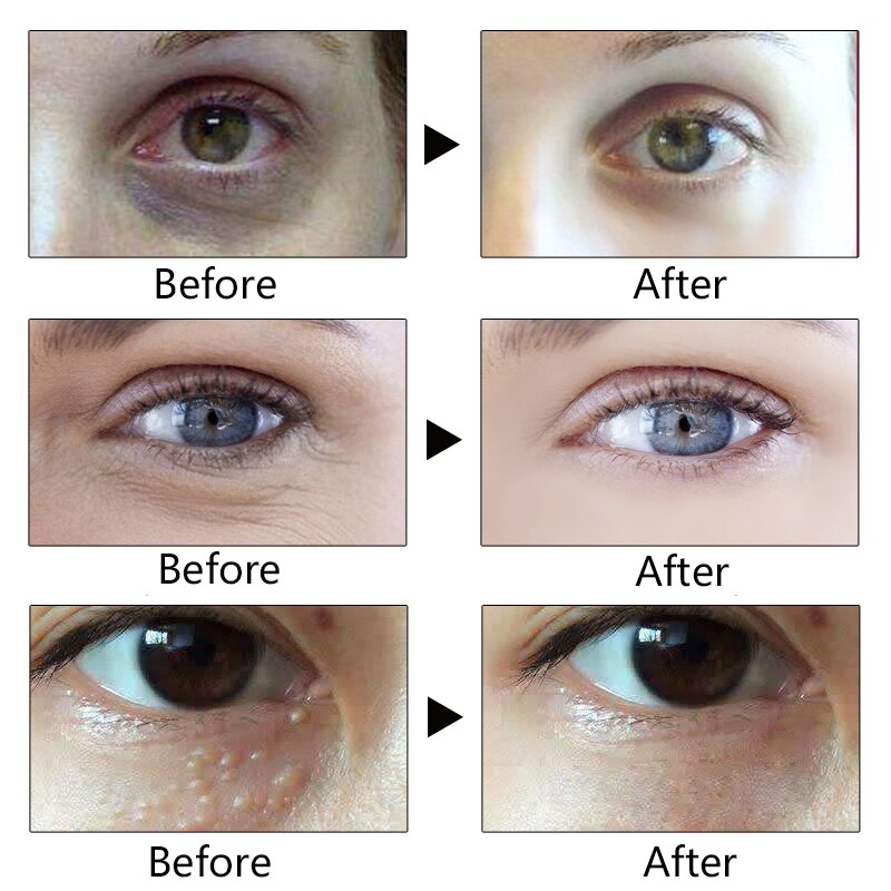 Anti-Wrinkle Eye Cream