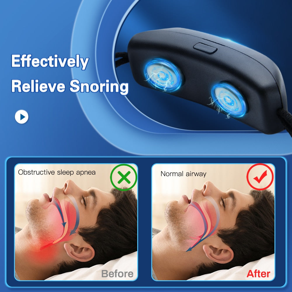 Smart Anti-Snoring Device With EMS Pulse