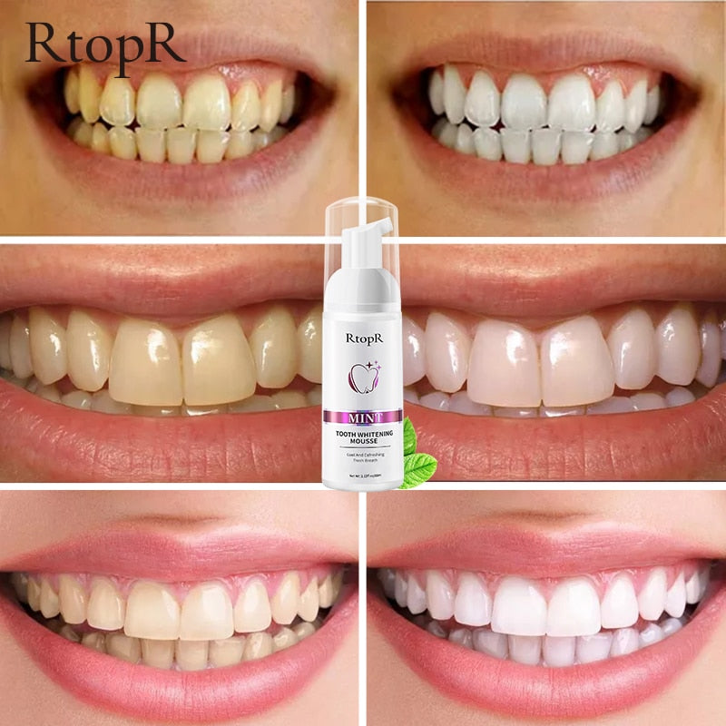 Teeth Whitening Cleansing Mousse